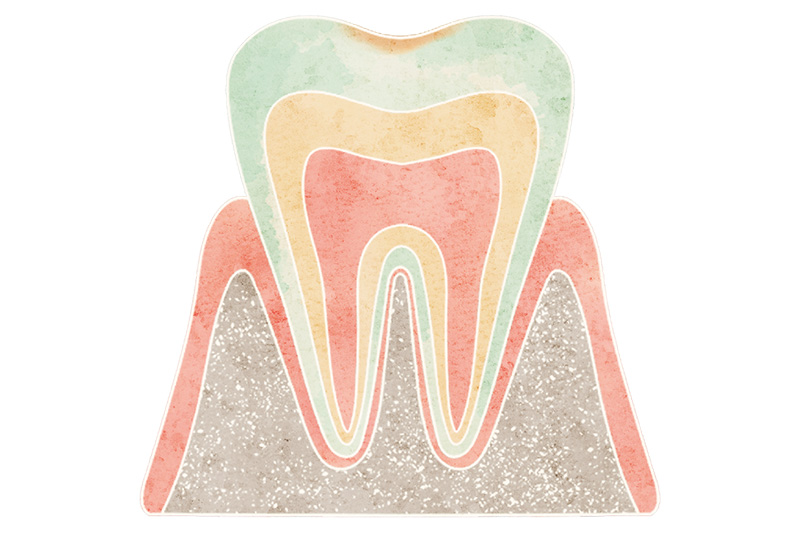 初期のむし歯（CO）