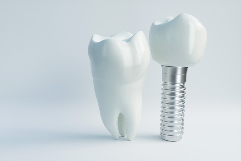 機能面のメリット