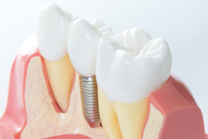 見た目の自然さ