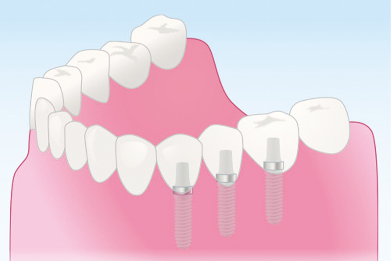 適応できる症例に限りがある
