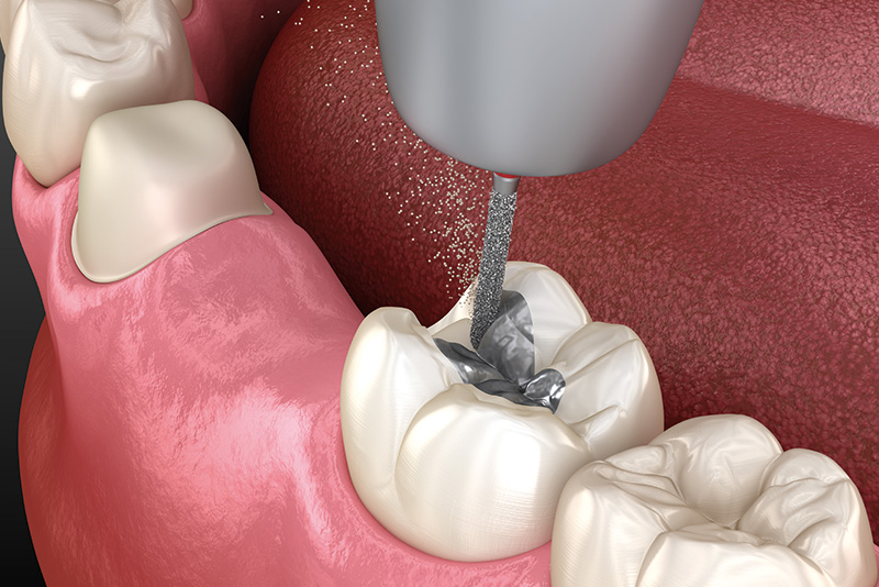 患者さんのご要望やお口の状態に合わせてご提案します